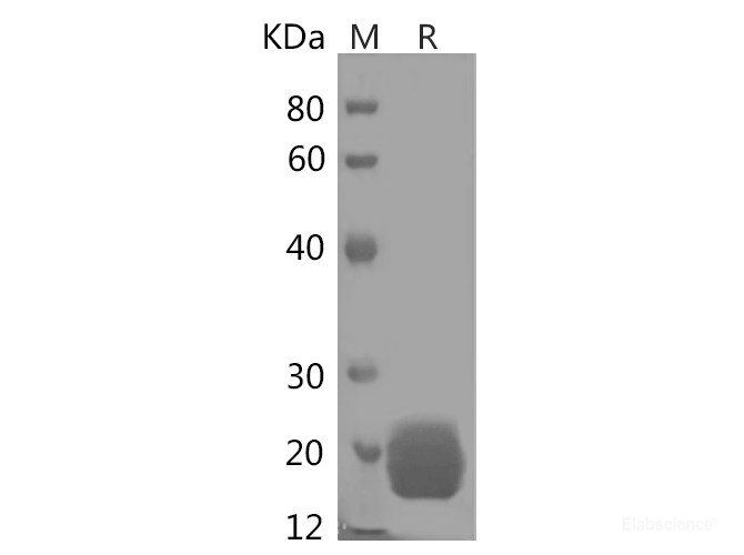 Recombinant Human LAIR2/CD306 Protein (His Tag)