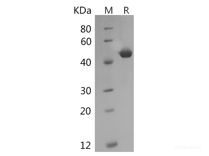 Recombinant Human SerpinE1/PAI-1 Protein (His Tag)