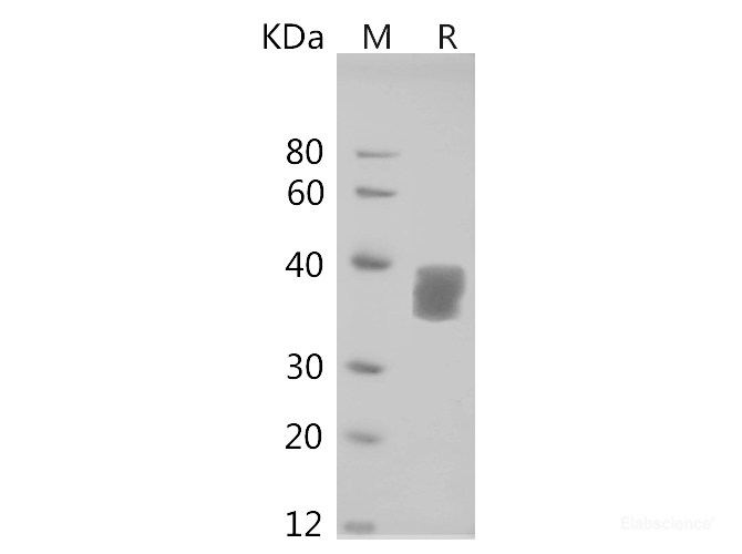 Recombinant Human Secretogranin 3/SCG3 Protein (His Tag)