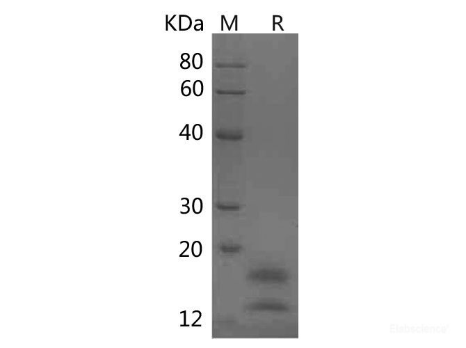 Recombinant Human VEGF121 protein(His tag)