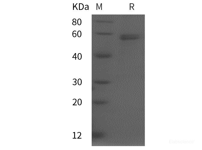 Recombinant Human MMP3 protein (His tag)