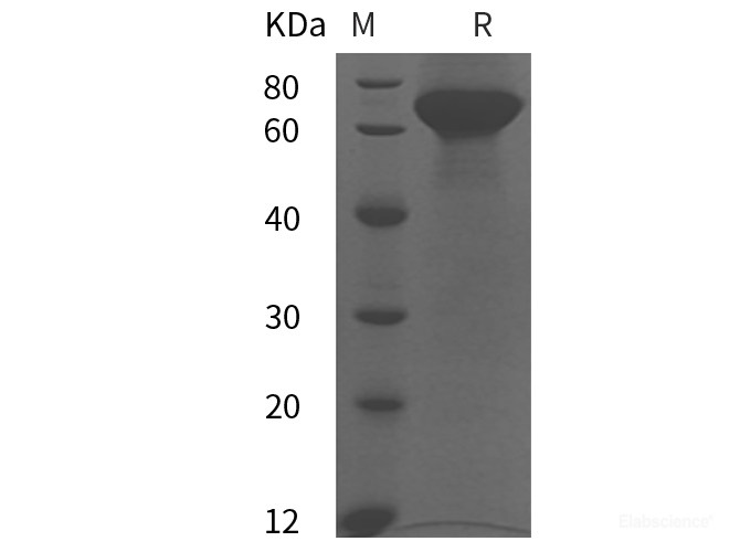 Recombinant Human MMP2 protein (His tag)