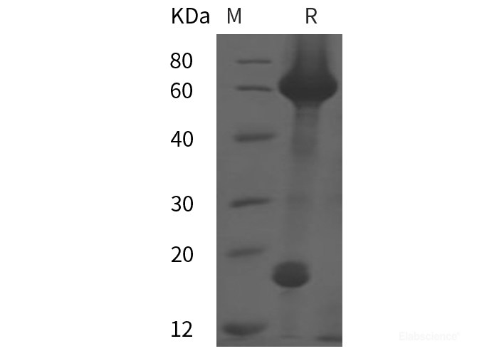 Recombinant Human PCSK9 protein (His tag)