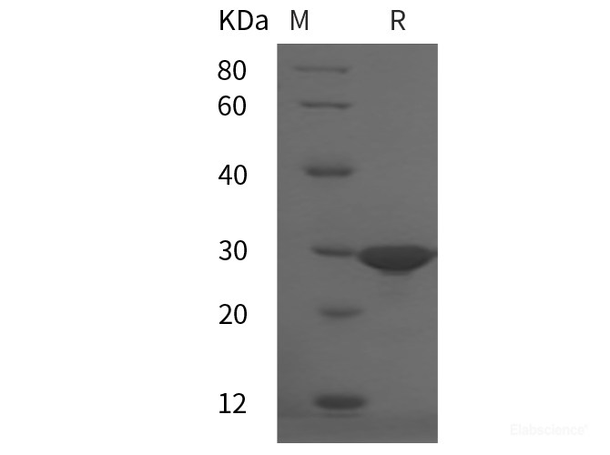 Recombinant Human HMGB1 protein (His tag)