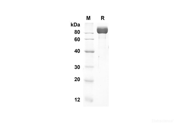 Recombinant Human DPP4 Protein(His Tag)-Elabscience
