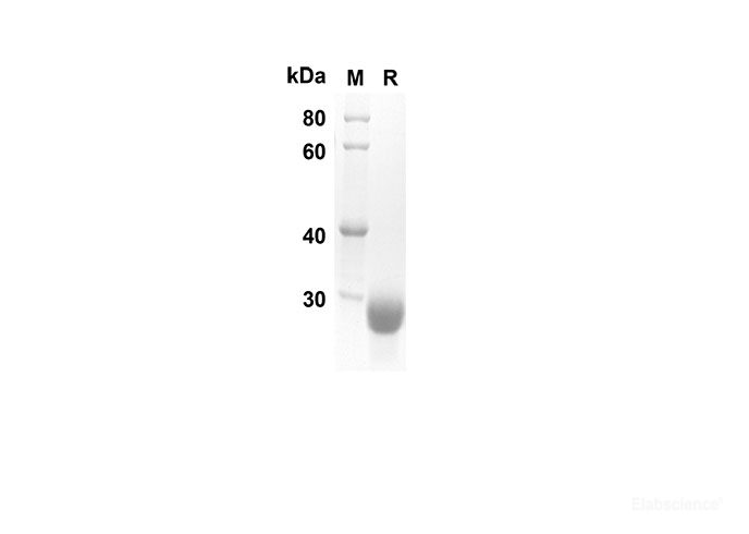 Recombinant Human NBL1 Protein(His Tag)-Elabscience
