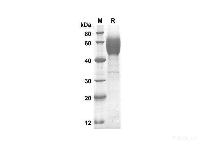 Recombinant Human CD30L Protein(Fc Tag)-Elabscience