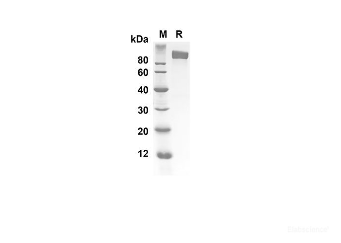 Recombinant Human IL6ST Protein(Fc Tag)-Elabscience
