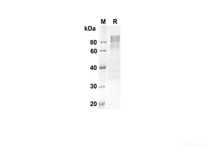 Recombinant Human CD30 Protein(Fc Tag)-Elabscience