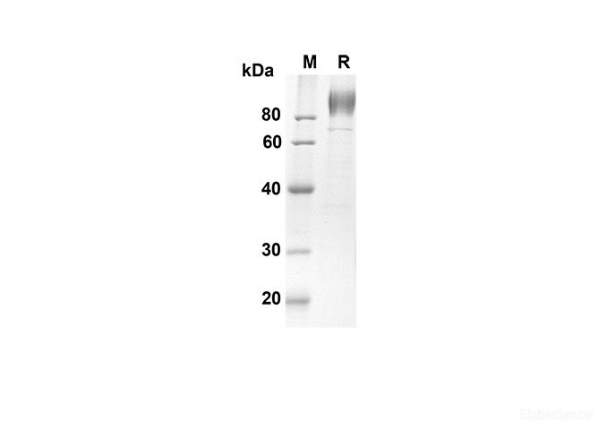 Recombinant Human IL6ST Protein(His Tag)-Elabscience