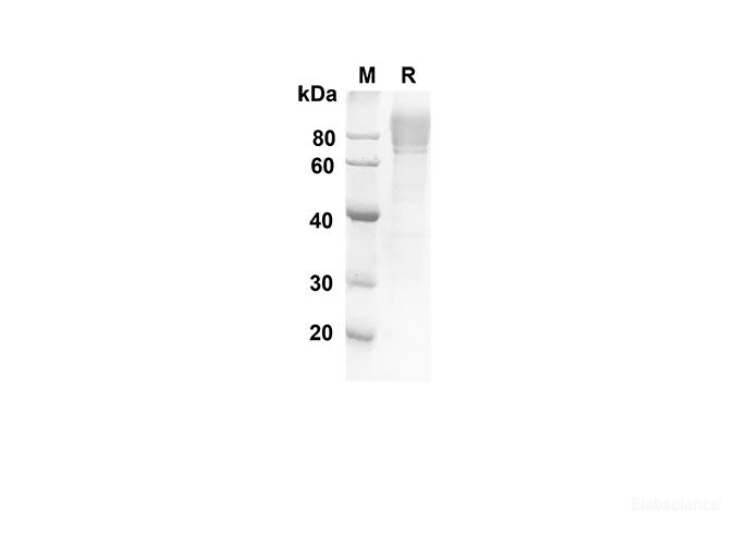 Recombinant Human ADGRE5 Protein(His Tag)-Elabscience