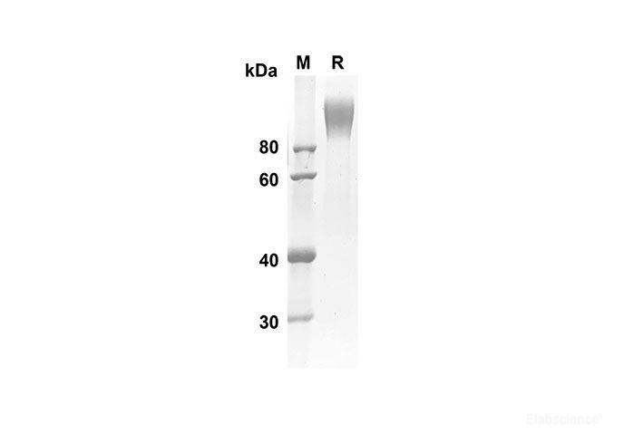 Recombinant Human CD6 Protein(Fc Tag)-Elabscience