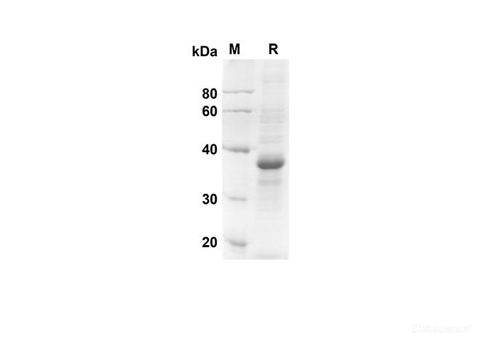 Recombinant human CCL3 Protein(Fc Tag)-Elabscience