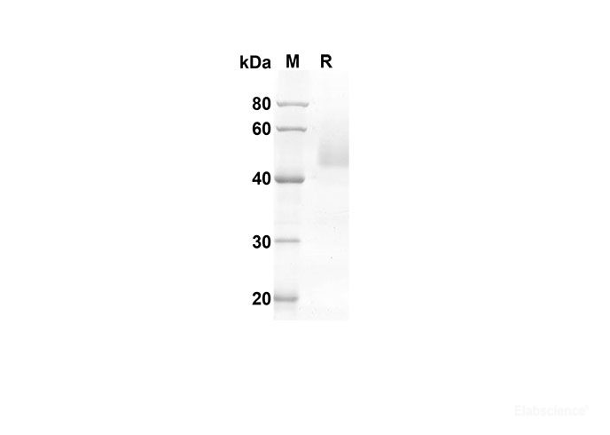 Recombinant Human FASL Protein(Fc Tag)-Elabscience