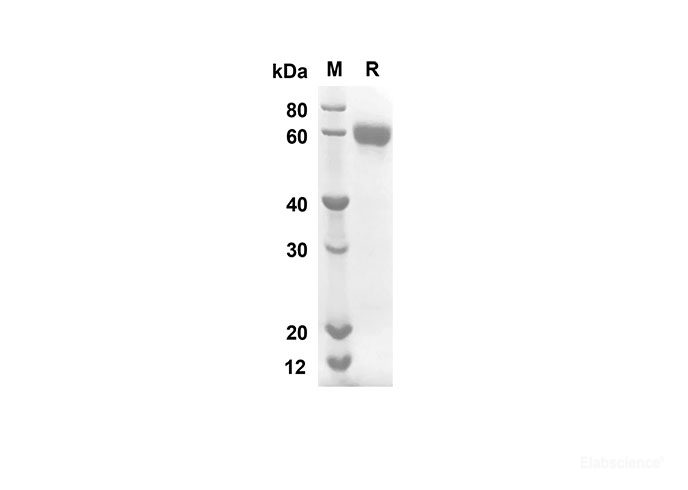 Recombinant Human IL2RA Protein(Fc Tag)-Elabscience