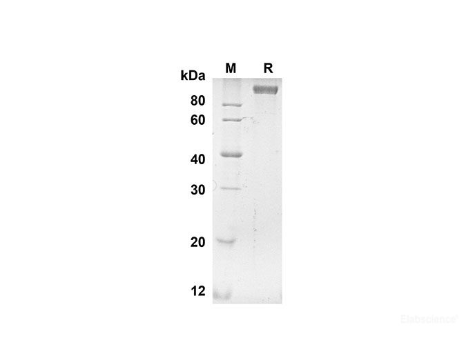 Recombinant Human ANPEP Protein(His Tag)-Elabscience