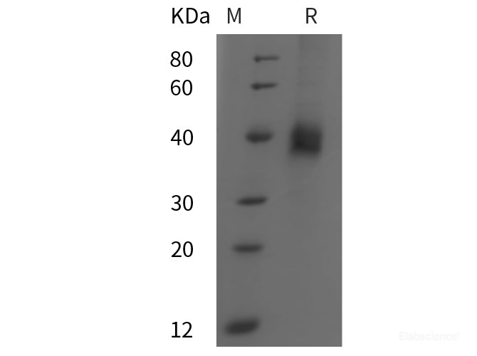 Recombinant Mouse DKK1 protein (His tag)