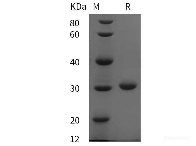 Recombinant Mouse COL4 protein (His tag)
