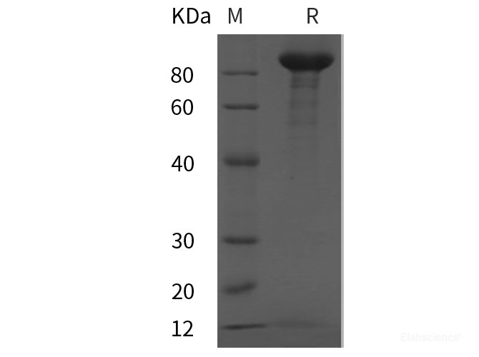 Recombinant Mouse MMP9 protein (His tag)