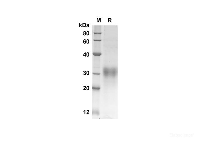 Recombinant Mouse Igfbp6 Protein(His Tag)-Elabscience