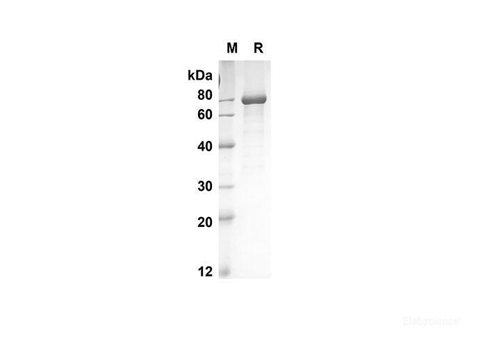 Recombinant Mouse OPG Protein(Fc Tag)-Elabscience