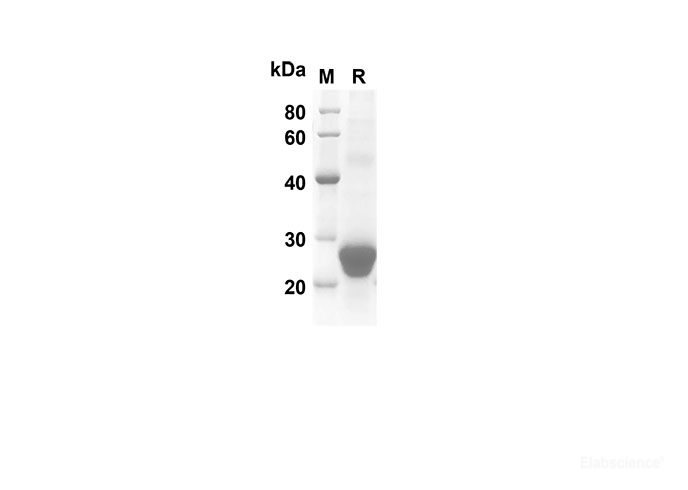 Recombinant Mouse CD70 Protein(His Tag)-Elabscience