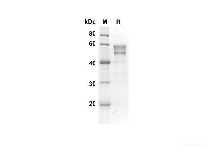 Recombinant Mouse HVEM/TNFRSF14 Protein(Fc Tag)-Elabscience