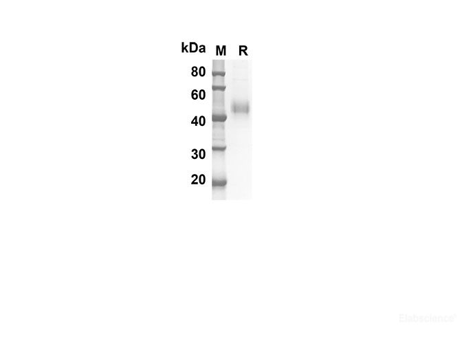 Recombinant Mouse Tfpi Protein(His Tag)-Elabscience