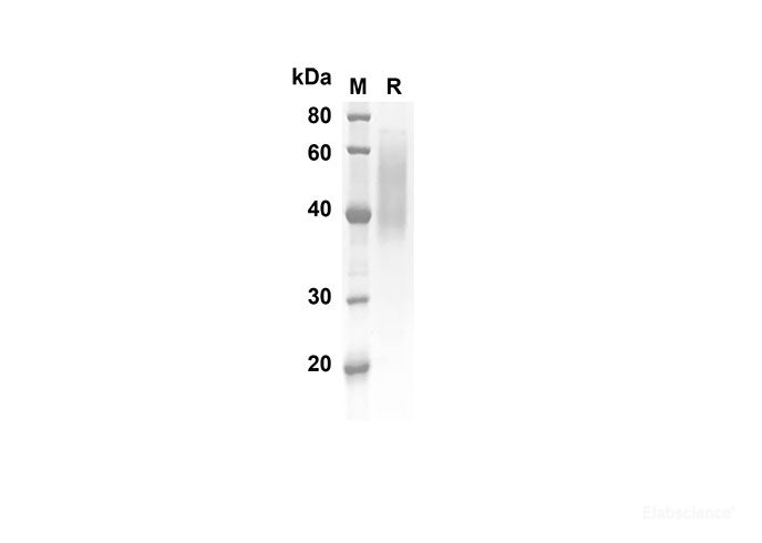 Recombinant Mouse CD30 Protein(His Tag)-Elabscience
