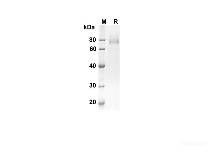 Recombinant Mouse CD36 Protein(His Tag)-Elabscience