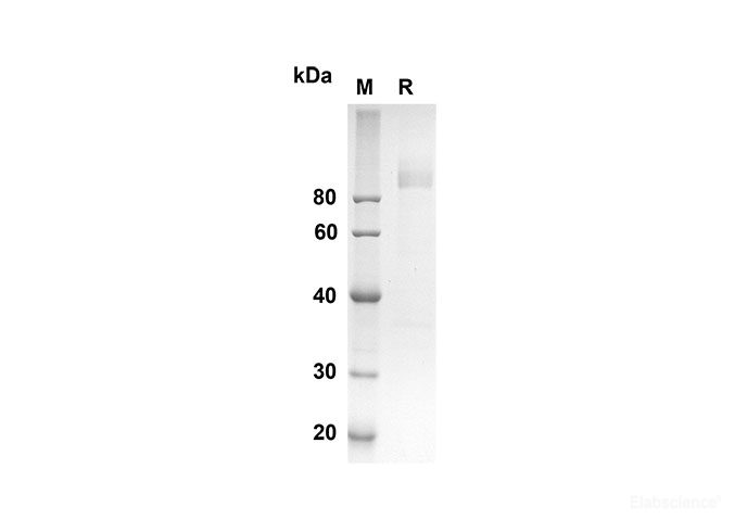 Recombinant Mouse CD36 Protein(Fc Tag)-Elabscience