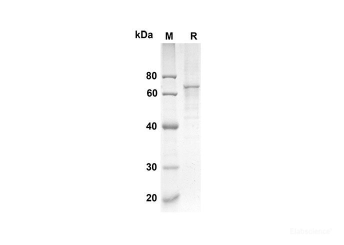 Recombinant Mouse CRTAM Protein(His Tag)-Elabscience