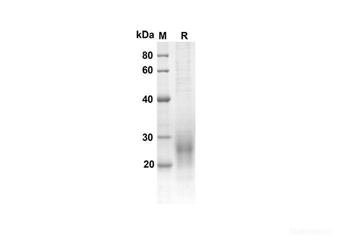 Recombinant Mouse ACVRL1 Protein(His Tag)-Elabscience
