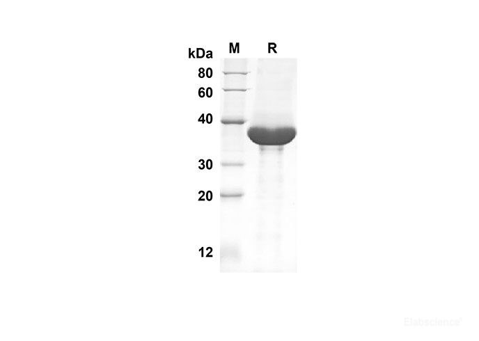 Recombinant Mouse CCL3 Protein(Fc Tag)-Elabscience