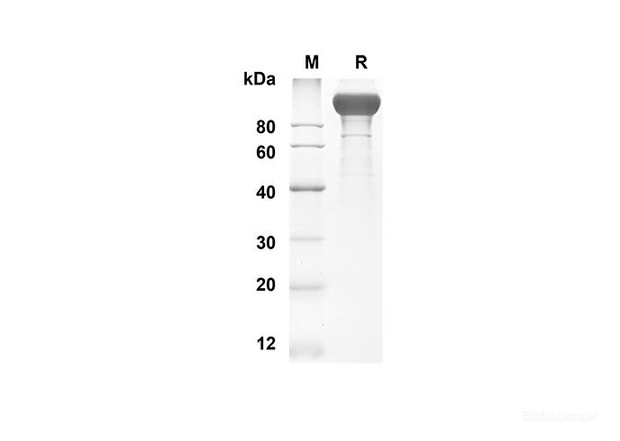 Recombinant Mouse VEGFR2 Protein(His Tag)-Elabscience