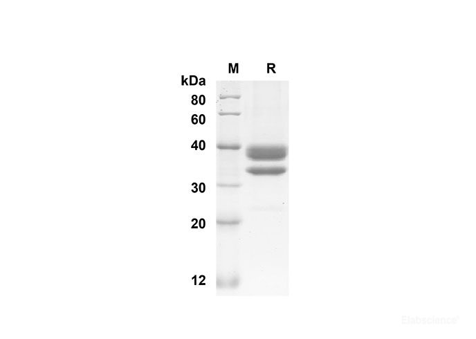 Recombinant Mouse  CCL1 Protein( Fc Tag)-Elabscience
