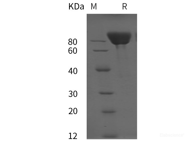 Recombinant Rat E-Cadherin/CDH1 Protein (His Tag)