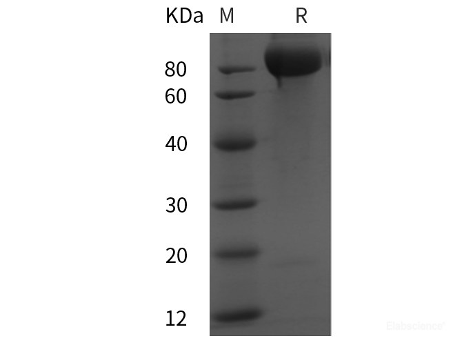 Recombinant Rat Vcam1 protein (His tag)