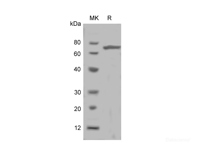 Recombinant Rat Growth Hormone Receptor/GHR protein (His tag)