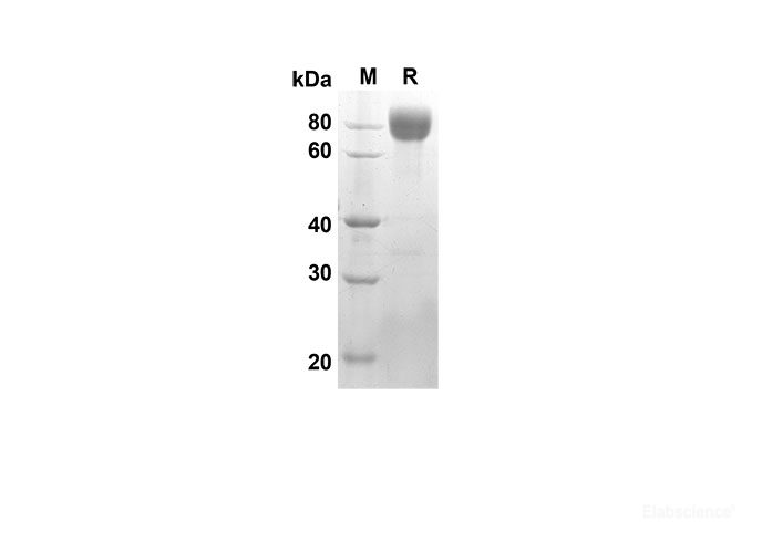 Recombinant Rat CD62L/L-Selectin Protein(Fc Tag)-Elabscience