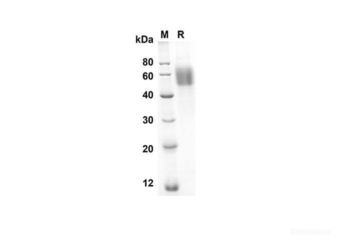 Recombinant Rat Il1R1/Il1RA Protein(His Tag)-Elabscience
