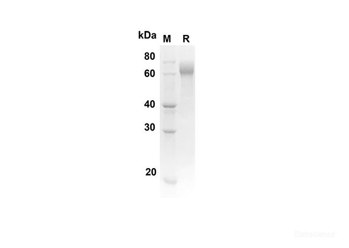 Recombinant Rat FGFR4 Protein(His Tag)-Elabscience