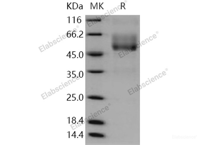 Recombinant Human Mucin-1 / MUC-1 Protein (Fc tag)-Elabscience