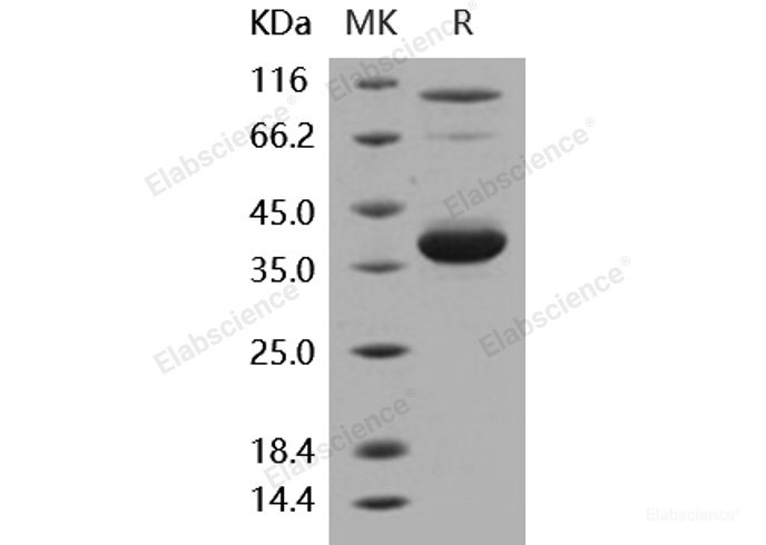 Recombinant Human IL-8 / CXCL8 Protein (aa 28-99, Fc tag)-Elabscience