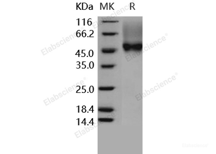 Recombinant Human CD16a / FCGR3A Protein (176 Val, His & AVI tag), Biotinylated-Elabscience
