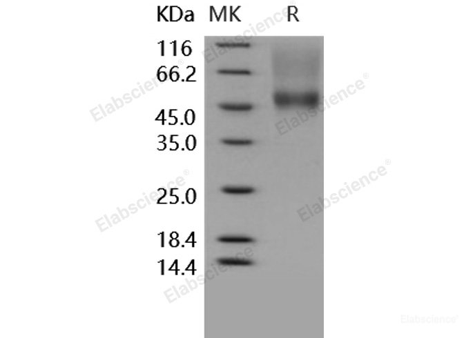 Recombinant Human CD16a / FCGR3A Protein (176 Phe, His & AVI tag), Biotinylated-Elabscience