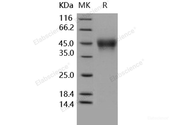 Recombinant Human CD16a / FCGR3A Protein (176 Val, His tag)-Elabscience