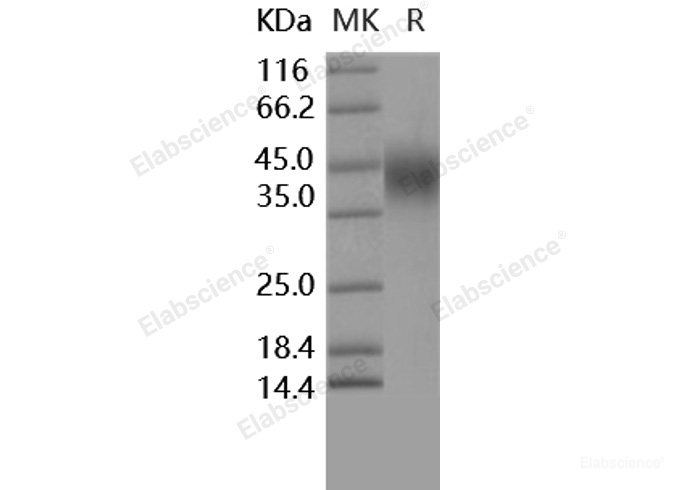 Recombinant Human CD16a / FCGR3A Protein (176 Phe, His tag)-Elabscience