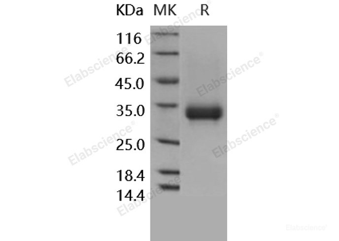 Recombinant Human CD32a / FCGR2A Protein (167 Arg, His & AVI tag), Biotinylated-Elabscience