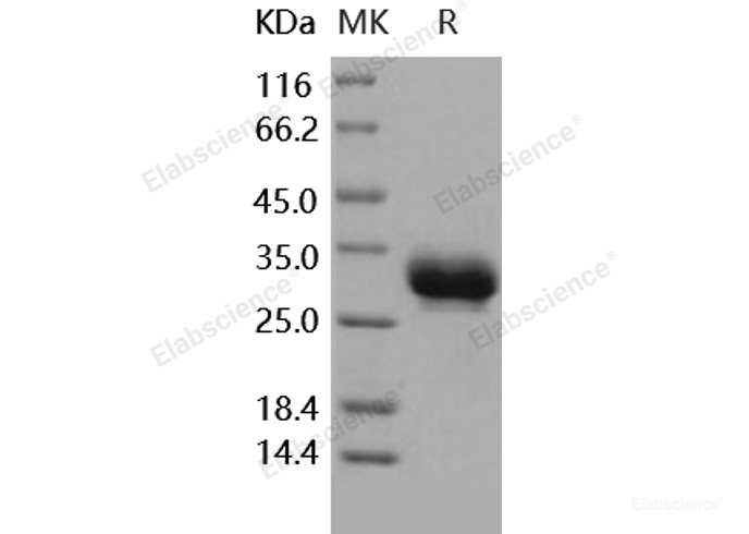 Recombinant Human CD32a / FCGR2A Protein (167 Arg, His tag)-Elabscience